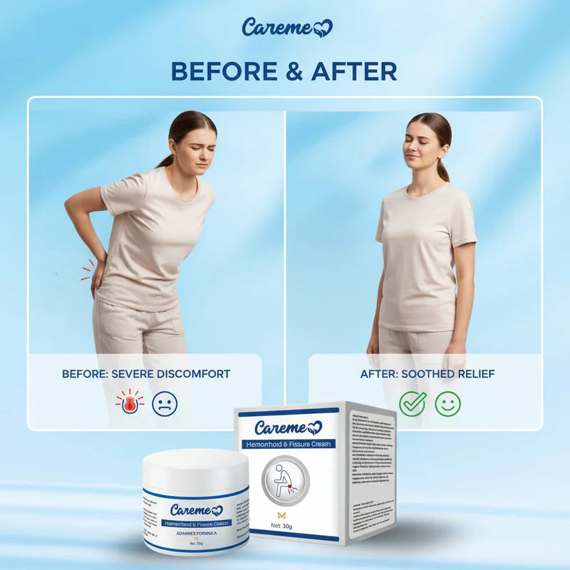Careme Hemorrhoid & Fissure Cream for Piles